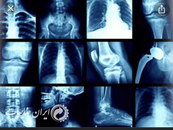 خرید ضایعات عکس رادیولوژی
